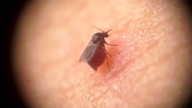 Con dĩn hút máu gây ra triệu chứng ngứa ngáy, sưng rộp