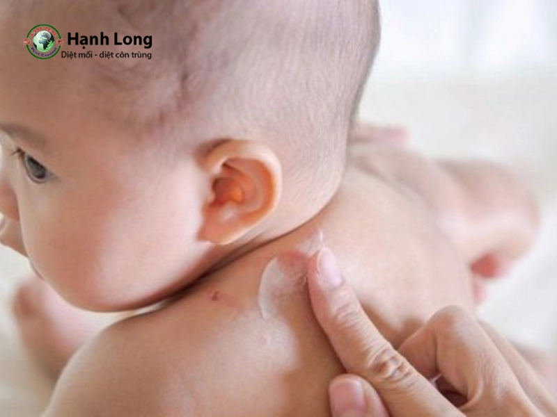 chống muỗi cho trẻ sơ sinh