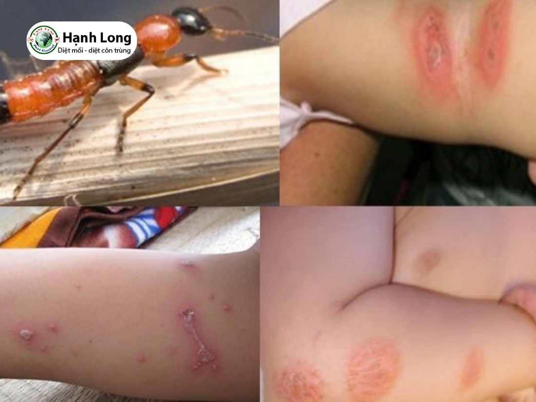 đuổi kiến ba khoang