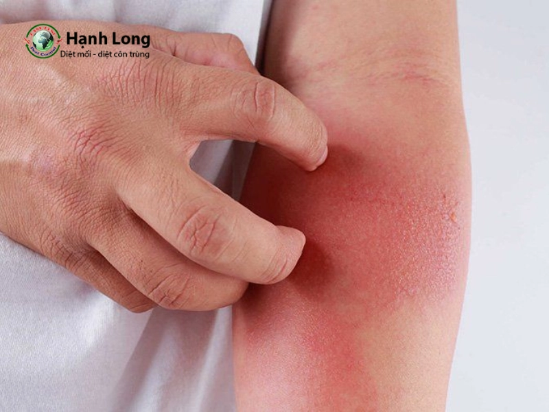 phun thuốc muỗi vào quần áo phun thuốc muỗi vào quần áo