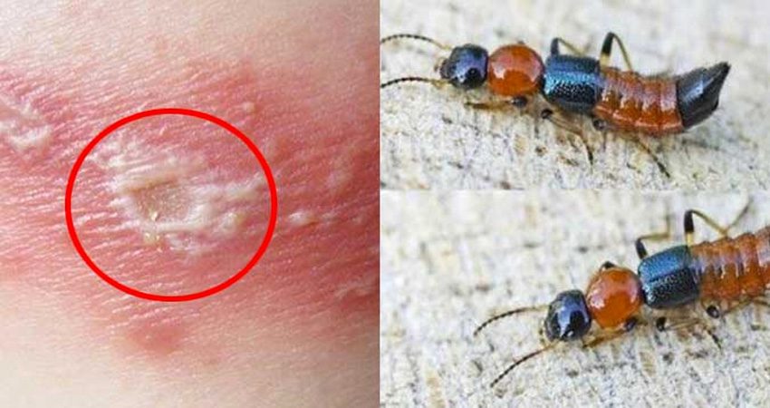 3 loại côn trùng đáng sợ nhất đối với con người