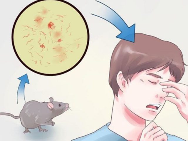 Mắc bệnh Sodoku vì bị chuột cắn